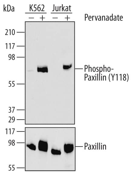 Western blot shows lysates of K562 human chronic myelogenous leukemia cell line and Jurkat human acute T cell leukemia cell line untreated (-) or treated (+) with Pervanadate for 5 minutes. PVDF membrane was probed with 2 µg/mL of Mouse Anti-Human Phospho-Paxillin (Y118) Antigen Affinity-purified Monoclonal Antibody (Catalog # MAB6164) followed by HRP-conjugated Anti-Mouse IgG Secondary Antibody (Catalog # HAF007). A specific band was detected for Phospho-Paxillin (Y118) at approximately 80 kDa (as indicated). For additional reference, the membran was stripped and reprobed with 2 µg/mL of Sheep Anti-Human/Mouse/Rat Paxillin Antigen Affinity-purified Polyclonal Antibody (lowerpanel, Catalog # AF4259). This experiment was conducted under reducing conditions and using Immunoblot Buffer Group 1.