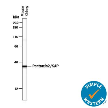 Simple Western Pentraxin 2/SAP Antibody [Unconjugated]