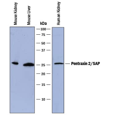 Western Blot Pentraxin 2/SAP Antibody [Unconjugated]
