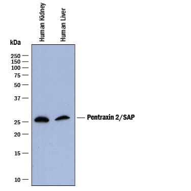 Western Blot Pentraxin 2/SAP Antibody (910119)