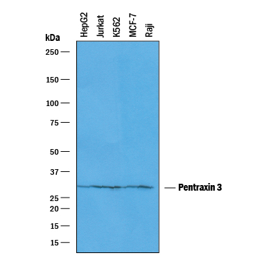Western blot shows lysates of HepG2 human hepatocellular carcinoma cell line, Jurkat human acute T cell leukemia cell line, K562 human chronic myelogenous leukemia cell line, MCF-7 human breast cancer cell line, and Raji human Burkitt's lymphoma cell line. PVDF membrane was probed with 1 µg/mL of Goat Anti-Human Pentraxin 3/TSG-14 Antigen Affinity-purified Polyclonal Antibody (Catalog # AF1826) followed by HRP-conjugated Anti-Goat IgG Secondary Antibody (Catalog # HAF019). A specific band was detected for Pentraxin 3/TSG-14 at approximately 40 kDa (as indicated). This experiment was conducted under reducing conditions and using Immunoblot Buffer Group 1.