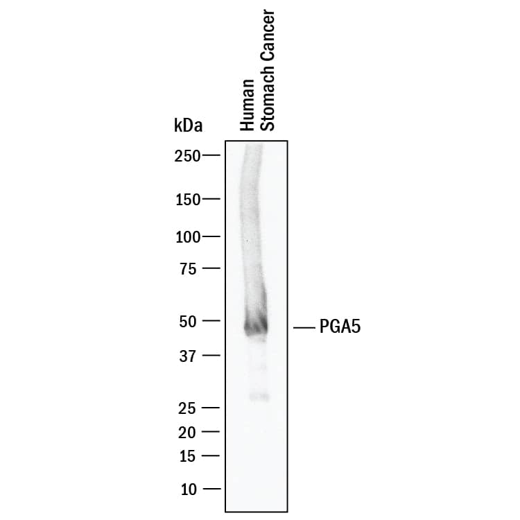 Western Blot PGA5 Antibody (974731) [Unconjugated]