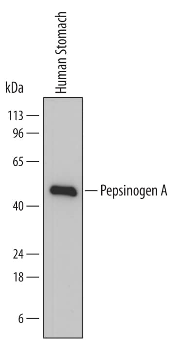 Western Blot Pepsinogen A Antibody (762015)
