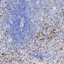 Perforin was detected in immersion fixed paraffin-embedded sections of human spleen using Mouse Anti-Human Perforin Monoclonal Antibody (Catalog # MAB8011) at 5 µg/mL for 1 hour at room temperature followed by incubation with the Anti-Mouse IgG VisUCyte™ HRP Polymer Antibody (Catalog # VC001). Before incubation with the primary antibody, tissue was subjected to heat-induced epitope retrieval using Antigen Retrieval Reagent-Basic (Catalog # CTS013). Tissue was stained using DAB (brown) and counterstained with hematoxylin (blue). Specific staining was localized to cell surfaces and cytoplasm in splenocytes. View our protocol for IHC Staining with VisUCyte HRP Polymer Detection Reagents.