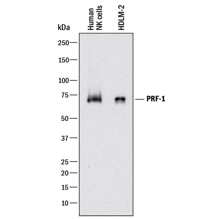 Western blot shows lysates of human NK cells and HDLM-2 human Hodgkin's lymphoma cell line. PVDF membrane was probed with 2 µg/mL of Mouse Anti-Human Perforin Monoclonal Antibody (Catalog # MAB8011) followed by HRP-conjugated Anti-Mouse IgG Secondary Antibody (Catalog # HAF018). A specific band was detected for Perforin at approximately 70 kDa (as indicated). This experiment was conducted under reducing conditions and using Immunoblot Buffer Group 1.