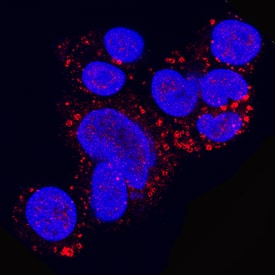 Perilipin-2 was detected in immersion fixed HepG2 human hepatocellular carcinoma cell line using Mouse Anti-Human Perilipin-2 Monoclonal Antibody (Catalog # MAB76341) at 8 µg/mL for 3 hours at room temperature. Cells were stained using the NorthernLights™ 557-conjugated Anti-Mouse IgG Secondary Antibody (red; Catalog # NL007) and counterstained with DAPI (blue). Specific staining was localized to cytoplasm. View our protocol for Fluorescent ICC Staining of Cells on Coverslips.