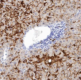 Perilipin-2 was detected in immersion fixed paraffin-embedded sections of human liver using Mouse Anti-Human Perilipin-2 Monoclonal Antibody (Catalog # MAB76341) at 5 µg/mL for 1 hour at room temperature followed by incubation with the Anti-Mouse IgG VisUCyte™ HRP Polymer Antibody (Catalog # VC001). Tissue was stained using DAB (brown) and counterstained with hematoxylin (blue). Specific staining was localized to cytoplasm in hepatocytes. View our protocol for IHC Staining with VisUCyte HRP Polymer Detection Reagents.