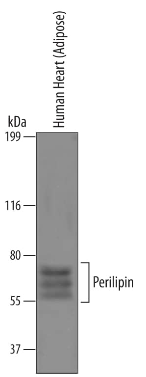Western blot shows lysates of human heart (adipose) tissue. PVDF Membrane was probed with 0.25 µg/mL of Human Perilipin Antigen Affinity-purified Polyclonal Antibody (Catalog # AF6615) followed by HRP-conjugated Anti-Sheep IgG Secondary Antibody (Catalog # HAF016). Specific bands were detected for Perilipin at approximately 55-70 kDa (as indicated). This experiment was conducted under reducing conditions and using Immunoblot Buffer Group 1.