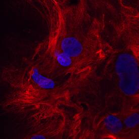 Immunocytochemistry Periostin/OSF-2 Antibody [Unconjugated]