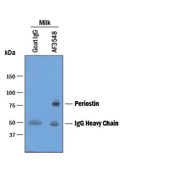 Human Periostin/OSF-2 was immunoprecipitated from human milk samples diluted in 1X Sample Diluent Concentrate 2 (DYC002) and incubated with 3 µg Goat Anti-Human Periostin/OSF-2 Antigen Affinity-purified Polyclonal Antibody (Catalog # AF3548) or Normal Goat IgG Control (AB-108-C) plus 30 µL Protein G beads overnight. Immunoprecipitated Periostin/OSF-2 was detected by Western blot under reducing conditions using 1 µg/mL Goat Anti-Human Periostin/OSF-2 Antigen Affinity-purified Polyclonal Antibody (Catalog # AF3548). View our recommended buffer recipes for immunoprecipitation.