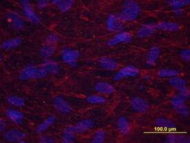Periostin/OSF-2 was detected in immersion fixed human osteocytes using Rat Anti-Human/Mouse Periostin/OSF-2 Monoclonal Antibody (Catalog # MAB3548) at 10 µg/mL for 3 hours at room temperature. Cells were stained red and counterstained with DAPI (blue).