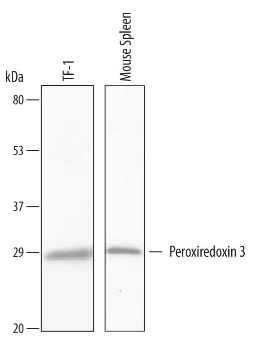 Western blot shows lysates of TF-1 human erythroleukemic cell line and mouse spleen tissue. PVDF Membrane was probed with 1 µg/mL of Human/Mouse Peroxiredoxin 3 Antigen Affinity-purified Polyclonal Antibody (Catalog # AF6610) followed by HRP-conjugated Anti-Goat IgG Secondary Antibody (Catalog # HAF019). A specific band was detected for Peroxiredoxin 3 at approximately 28 kDa (as indicated). This experiment was conducted under reducing conditions and using Immunoblot Buffer Group 8.