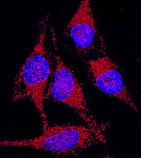 Peroxiredoxin 3 was detected in immersion fixed HeLa human cervical epithelial carcinoma cell line using Mouse Anti-Human Peroxiredoxin 3 Monoclonal Antibody (Catalog # MAB7504) at 10 µg/mL for 3 hours at room temperature. Cells were stained using the NorthernLights™ 557-conjugated Anti-Mouse IgG Secondary Antibody (red; Catalog # NL007) and counterstained with DAPI (blue). Specific staining was localized to cytoplasm. View our protocol for Fluorescent ICC Staining of Cells on Coverslips.