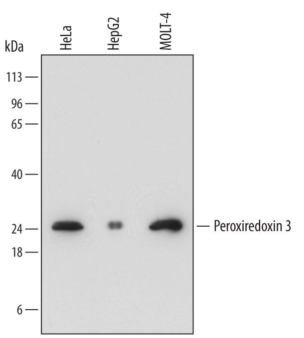 Western blot shows lysates of HeLa human cervical epithelial carcinoma cell line, HepG2 human hepatocellular carcinoma cell line, and MOLT-4 human acute lymphoblastic leukemia cell line. PVDF membrane was probed with 0.2 µg/mL of Mouse Anti-Human Peroxiredoxin 3 Monoclonal Antibody (Catalog # MAB7504) followed by HRP-conjugated Anti-Mouse IgG Secondary Antibody (Catalog # HAF018). A specific band was detected for Peroxiredoxin 3 at approximately 25 kDa (as indicated). This experiment was conducted under reducing conditions and using Immunoblot Buffer Group 1.