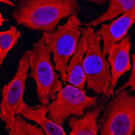 Peroxiredoxin 4 was detected in immersion fixed HeLa human cervical epithelial carcinoma cell line using Mouse Anti-Human Peroxiredoxin 4 Monoclonal Antibody (Catalog # MAB5460) at 10 µg/mL for 3 hours at room temperature. Cells were stained using the NorthernLights™ 557-conjugated Anti-Mouse IgG Secondary Antibody (red; Catalog # NL007) and counterstained with DAPI (blue). Specific staining was localized to cytoplasm. View our protocol for Fluorescent ICC Staining of Cells on Coverslips.
