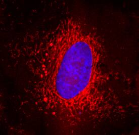 Peroxiredoxin 5 was detected in immersion fixed A549 human lung carcinoma cell line using Goat Anti-Human/Mouse/Rat Peroxiredoxin 5 Antigen Affinity-purified Polyclonal Antibody (Catalog # AF5724) at 10 µg/mL for 3 hours at room temperature. Cells were stained using the NorthernLights™ 557-conjugated Anti-Goat IgG Secondary Antibody (red; Catalog # NL001) and counterstained with DAPI (blue). Specific staining was localized to mitochondria. View our protocol for Fluorescent ICC Staining of Cells on Coverslips.