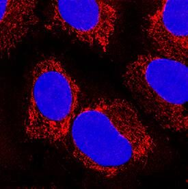 Peroxiredoxin 5 was detected in immersion fixed A549 human lung carcinoma cell line using Goat Anti-Human/Mouse/Rat Peroxiredoxin 5 Antigen Affinity-purified Polyclonal Antibody (Catalog # AF5724) at 15 µg/mL for 3 hours at room temperature. Cells were stained using the NorthernLights™ 557-conjugated Anti-Goat IgG Secondary Antibody (red; Catalog # NL001) and counterstained with DAPI (blue). Specific staining was localized to cytoplasm (mitochondria). View our protocol for Fluorescent ICC Staining of Cells on Coverslips.
