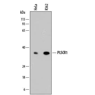 Western Blot Phospholipid Scramblase 1/PLSCR1 Antibody (875327)