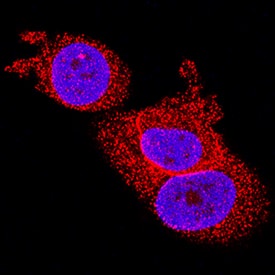 Pin1 was detected in immersion fixed MCF-7 human breast cancer cell line using Mouse Anti-Human/Mouse Pin1 Monoclonal Antibody (Catalog # MAB2294) at 8 µg/mL for 3 hours at room temperature. Cells were stained using the NorthernLights™ 557-conjugated Anti-Mouse IgG Secondary Antibody (red; Catalog # NL007) and counterstained with DAPI (blue). Specific staining was localized to nuclei and cytoplasm. View our protocol for Fluorescent ICC Staining of Cells on Coverslips.