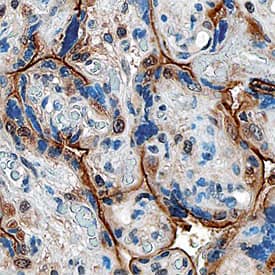 PlGF was detected in formalin fixed paraffin-embedded sections of human placenta using Sheep Anti-Human PlGF Antigen Affinity-purified Polyclonal Antibody (Catalog # AF6837) at 10 µg/mL overnight at 4 °C. Before incubation with the primary antibody, tissue was subjected to heat-induced epitope retrieval using Antigen Retrieval Reagent-Basic (Catalog # CTS013). Tissue was stained using the Anti-Sheep HRP-DAB Cell & Tissue Staining Kit (brown; Catalog # CTS019) and counterstained with hematoxylin (blue). Specific staining was localized to syncytiotrophoblasts. View our protocol for Chromogenic IHC Staining of Paraffin-embedded Tissue Sections.
