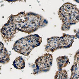 PlGF was detected in immersion fixed paraffin-embedded sections of human placenta using Human PlGF Monoclonal Antibody (Catalog # MAB2642) at 25 µg/mL overnight at 4 °C. Tissue was stained using the Anti-Rat HRP-DAB Cell & Tissue Staining Kit (brown; Catalog # CTS017) and counterstained with hematoxylin (blue). Specific staining was localized to syncytiotrophoblast cells. View our protocol for Chromogenic IHC Staining of Paraffin-embedded Tissue Sections.