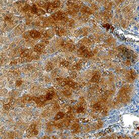Plasma Kallikrein/KLKB1 was detected in immersion fixed paraffin-embedded sections of human liver using Mouse Anti-Human Plasma Kallikrein/KLKB1 Monoclonal Antibody (Catalog # MAB2497) at 8 µg/mL overnight at 4 °C. Tissue was stained using the Anti-Mouse HRP-DAB Cell & Tissue Staining Kit (brown; Catalog # CTS002) and counterstained with hematoxylin (blue). Specific staining was localized to hepatocyte cytoplasm. View our protocol for Chromogenic IHC Staining of Paraffin-embedded Tissue Sections.