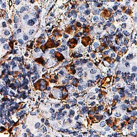 Immunohistochemistry Pleiotrophin/PTN Antibody [Unconjugated]