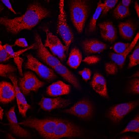 Pleiotrophin/PTN was detected in immersion fixed PC-3 human prostate cancer cell line using Rat Anti-Human Pleiotrophin/PTN Monoclonal Antibody (Catalog # MAB252) at 10 µg/mL for 3 hours at room temperature. Cells were stained using the NorthernLights™ 557-conjugated Anti-Rat IgG Secondary Antibody (red; Catalog # NL013) and counterstained with DAPI (blue). Specific staining was localized to cytoplasm. View our protocol for Fluorescent ICC Staining of Cells on Coverslips.