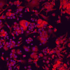 Immunocytochemistry Plexin A1 Antibody [Unconjugated]