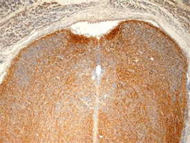 Immunohistochemistry Plexin A1 Antibody [Unconjugated]