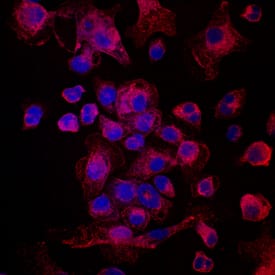 Plexin A1 was detected in immersion fixed immature human dendritic cells using Mouse Anti-Human Plexin A1 Monoclonal Antibody (Catalog # MAB6536) at 10 µg/mL for 3 hours at room temperature. Cells were stained using the NorthernLights™ 557-conjugated Anti-Mouse IgG Secondary Antibody (red; Catalog # NL007) and counterstained with DAPI (blue). Specific staining was localized to cell surfaces and cytoplasm. View our protocol for Fluorescent ICC Staining of Non-adherent Cells.