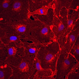 Immunocytochemistry Plexin A2 Antibody [Unconjugated]