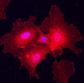 Immunocytochemistry Plexin A2 Antibody [Unconjugated]