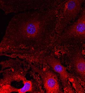 Plexin A2 was detected in immersion fixed bEnd.3 mouse endothelioma cell line using Rat Anti-Mouse Plexin A2 Monoclonal Antibody (Catalog # MAB5486) at 10 µg/mL for 3 hours at room temperature. Cells were stained using the NorthernLights™ 557-conjugated Anti-Rat IgG Secondary Antibody (red; Catalog # NL013) and counterstained with DAPI (blue). Specific staining was localized to cell surfaces and cytoplasm. View our protocol for Fluorescent ICC Staining of Cells on Coverslips.