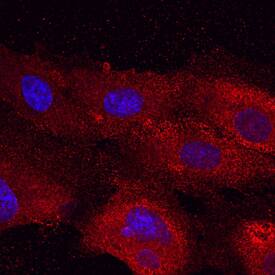 Plexin A2 was detected in immersion fixed HUVEC human umbilical vein endothelial cells using Rat Anti-Mouse Plexin A2 Monoclonal Antibody (Catalog # MAB5486) at 10 µg/mL for 3 hours at room temperature. Cells were stained using the Northern-Lights™ 557-conjugated Anti-Rat IgG Secondary Antibody (red; Catalog # NL013) and counterstained with DAPI (blue). Specific staining was localized to cell surfaces and cytoplasm. View our protocol for Fluorescent ICC Staining of Cells on Coverslips.