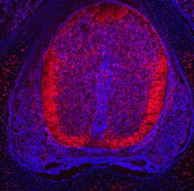 Immunohistochemistry Plexin A3 Antibody [Unconjugated]