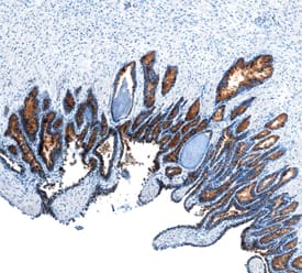 Plexin B1 was detected in immersion fixed paraffin-embedded sections of human prostate using Human Plexin B1 Monoclonal Antibody (Catalog # MAB37492) at 15 µg/mL overnight at 4 °C. Before incubation with the primary antibody, tissue was subjected to heat-induced epitope retrieval using Antigen Retrieval Reagent-Basic (Catalog # CTS013). Tissue was stained using the Anti-Mouse HRP-DAB Cell & Tissue Staining Kit (brown; Catalog # CTS002) and counterstained with hematoxylin (blue). Specific staining was localized to the cytoplasm in glandular epithelial cells. View our protocol for Chromogenic IHC Staining of Paraffin-embedded Tissue Sections.