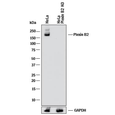 Western blot shows lysates of HeLa human cervical epithelial carcinoma parental cell line and Plexin B2 knockout HeLa cell line (KO). PVDF membrane was probed with 0.5 µg/mL of Sheep Anti-Human Plexin B2 Antigen Affinity-purified Polyclonal Antibody (Catalog # AF5329) followed by HRP-conjugated Anti-Sheep IgG Secondary Antibody (Catalog # HAF016). A specific band was detected for Plexin B2 at approximately 170 kDa (as indicated) in the parental HeLa cell line, but is not detectable in knockout HeLa cell line. GAPDH (Catalog # AF5718) is shown as a loading control. This experiment was conducted under reducing conditions and using Immunoblot Buffer Group 1.