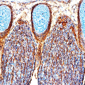 Immunohistochemistry Plexin B2 Antibody [Unconjugated]