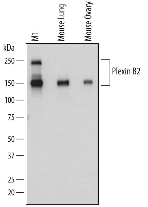 Western Blot Plexin B2 Antibody [Unconjugated]