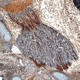 Plexin B2 was detected in immersion fixed frozen sections of mouse embryo (15 d.p.c.) using Rat Anti-Mouse Plexin B2 Monoclonal Antibody (Catalog # MAB6836) at 25 µg/mL overnight at 4 °C. Tissue was stained using the Anti-Rat HRP-DAB Cell & Tissue Staining Kit (brown; Catalog # CTS017) and counterstained with hematoxylin (blue). Specific staining was localized to neuronal processes. View our protocol for Chromogenic IHC Staining of Frozen Tissue Sections.