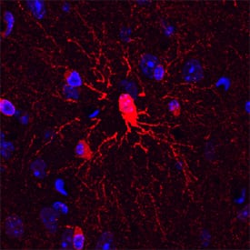 Plexin B3 was detected in perfusion fixed frozen sections of mouse brain using Sheep Anti-Mouse/Rat Plexin B3 Antigen Affinity-purified Polyclonal Antibody (Catalog # AF6879) at 1.7 µg/mL overnight at 4 °C. Tissue was stained using the NorthernLights™ 557-conjugated Anti-Sheep IgG Secondary Antibody (red; Catalog # NL010) and counterstained with DAPI (blue). Specific staining was localized to oligodendrocytes. View our protocol for Fluorescent IHC Staining of Frozen Tissue Sections.
