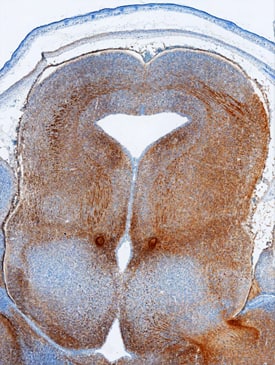 Immunohistochemistry Plexin C1 Antibody [Unconjugated]