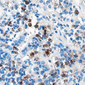 Immunohistochemistry Plexin C1 Antibody (544232)