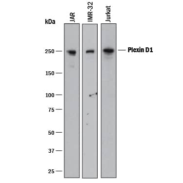 Western Blot Plexin D1 Antibody [Unconjugated]