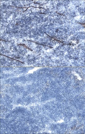 Podocalyxin was detected in perfusion fixed frozen sections of mouse thymus using Goat Anti-Mouse Podocalyxin Antigen Affinity-purified Polyclonal Antibody (Catalog # AF1556) at 15 µg/mL overnight at 4 °C. Tissue was stained using the Anti-Goat HRP-DAB Cell & Tissue Staining Kit (brown; CTS008) and counterstained with hematoxylin (blue). Lower panel shows a lack of labeling when primary antibodies are omitted and tissue is stained only with secondary antibody followed by incubation with detection reagents. Specific staining was localized to high endothelial venules. View our protocol for Chromogenic IHC Staining of Frozen Tissue Sections.