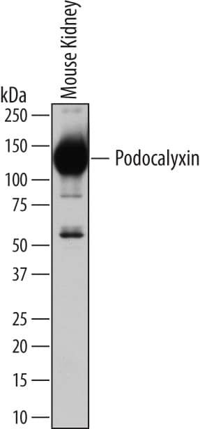 Western blot shows lysates of mouse kidney tissue. PVDF membrane was probed with 1 µg/mL of Goat Anti-Mouse Podocalyxin Antigen Affinity-purified Polyclonal Antibody (Catalog # AF1556) followed by HRP-conjugated Anti-Goat IgG Secondary Antibody (HAF109). A specific band was detected for Podocalyxin at approximately 130 kDa (as indicated). This experiment was conducted under reducing conditions and using Immunoblot Buffer Group 1.