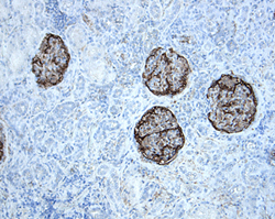 Immunohistochemistry Podocalyxin Like Antibody [Unconjugated]