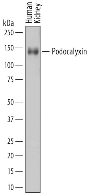 Western Blot Podocalyxin Like Antibody [Unconjugated]