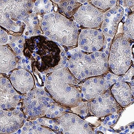 Immunohistochemistry Podocalyxin Like Antibody (192703) [Unconjugated]